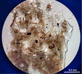 Using sewage sludge to fertilise fields can promote the uncontrolled release of microplastics into the wider environment (seen here: Microplastic fibres amongst plant fibres from a soil sample).